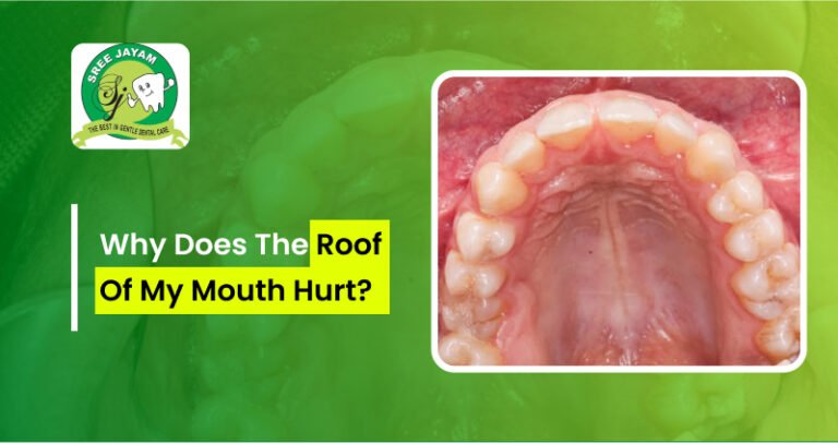 Why Does My Roof Of Mouth Hurt